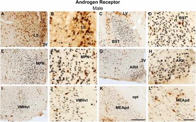 Frontiers Sex Differences In The Coexpression Of Prokineticin